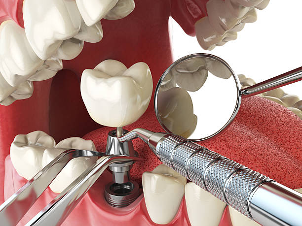 Best Emergency Dental Care for Sports Injuries in Dahlgren, VA
